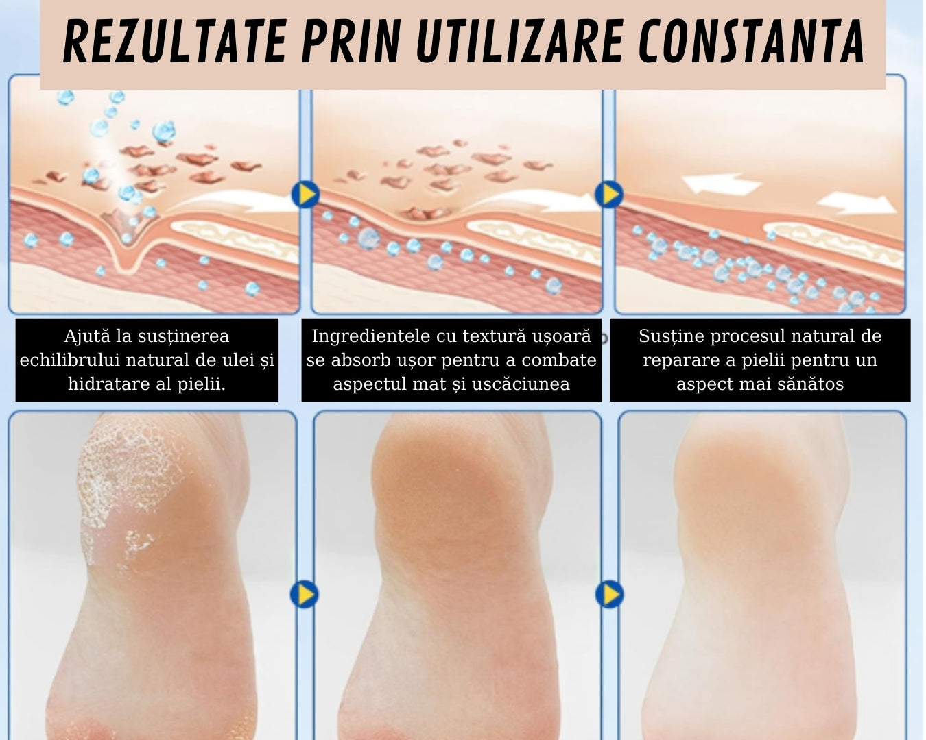 Hidratant profund anti‑crăpături