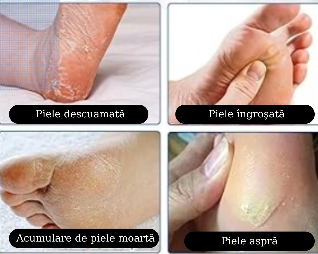 Hidratant profund anti‑crăpături