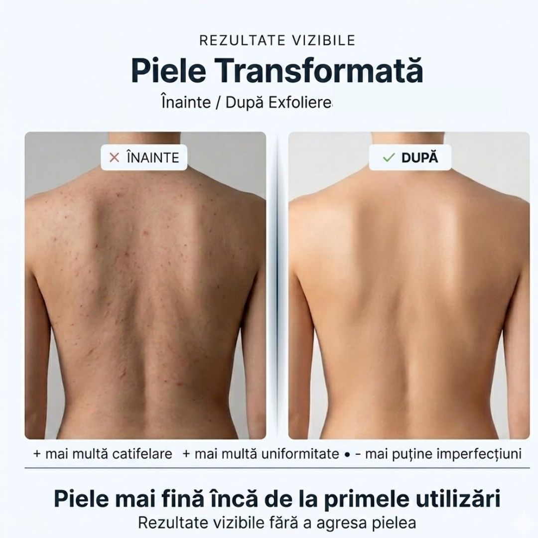 Prosopul exfoliant de duș